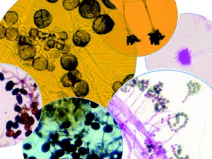 Magnified Mold Spores